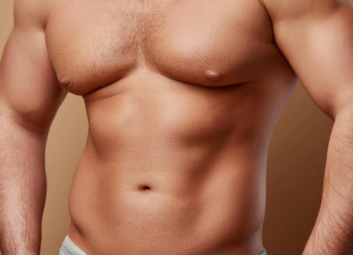 γυναικομαστία